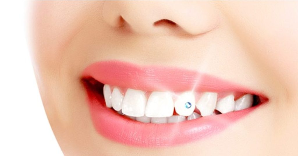 Diş Kristali ve Diş Pırlantası Komple Set – Muhteşem üş Seti